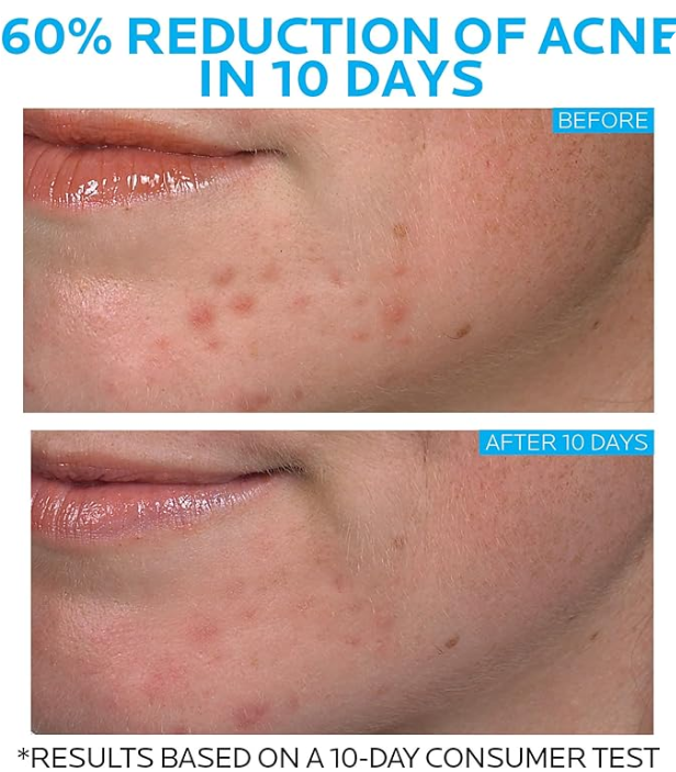 La Roche-Posay Effaclar Duo Dual Action Acne Spot Treatment Cream with Benzoyl Peroxide Acne Treatment, Blemish Cream for Acne and Blackheads, Lightweight Sheerness, Safe For Sensitive Skin,0.7 Fl Oz