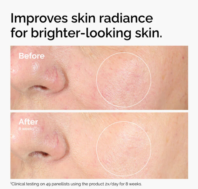 The Ordinary Alpha Arbutin 2% + HA - 30 ml