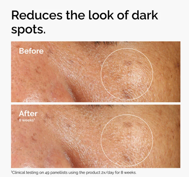 The Ordinary Alpha Arbutin 2% + HA - 30 ml